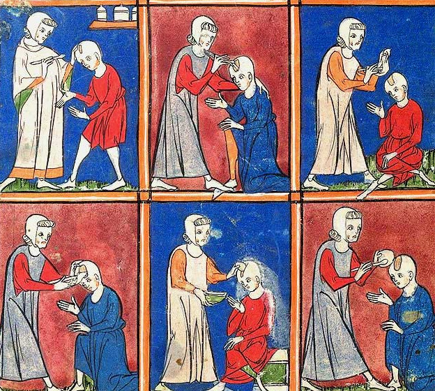 Medieval surgical procedures c. 1300. From illustrated manuscript, British Library (Shelfmark: Sloane 1977 f.2)